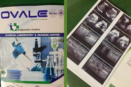 ultrasound report from ovale in jaipur, india